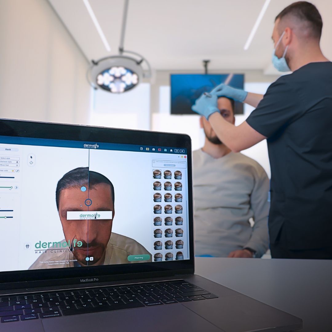 Me ne, flokët janë një hall më pak - Dermolife