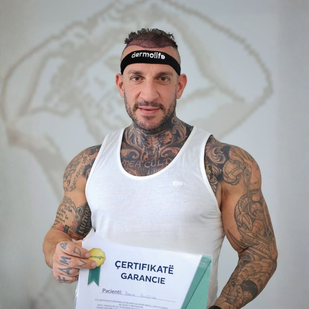 procedura mbjelljes se flokeve