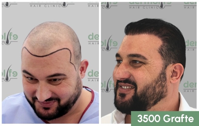 mbjellje me dhi