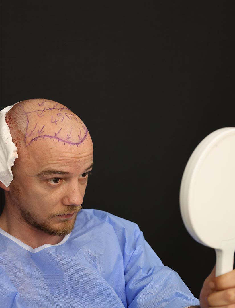 Konsultimi dhe vlerësimi para mbjelljes