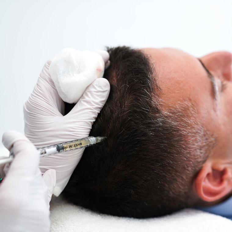 Procedura PRP në klinikën Dermolife